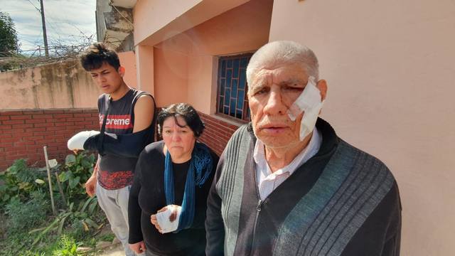 Dogo atacó a cuatro personas y lo mataron a cuchillazos