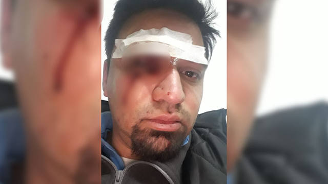 Paro en la línea 203 por salvaje agresión a chofer