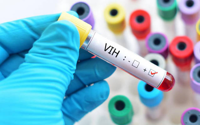 FOTO: Estiman que la vacuna contra el VIH estará lista en 2023