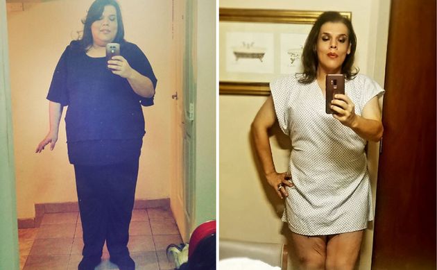 Costa antes y después