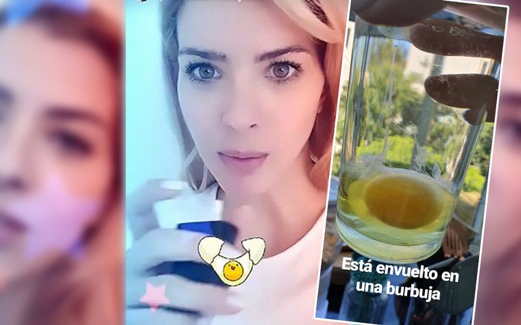 China Suárez - Cura del huevo