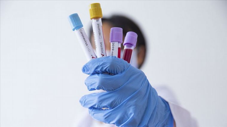 Del total de nuevos infectados, 49 corresponden a la capital y 91 al interior. 