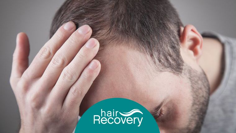 Aumentan los casos de caída de cabello en cuarentena