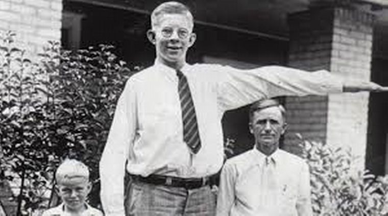 Robert Wadlow,hombre más alto del mundo,récord,