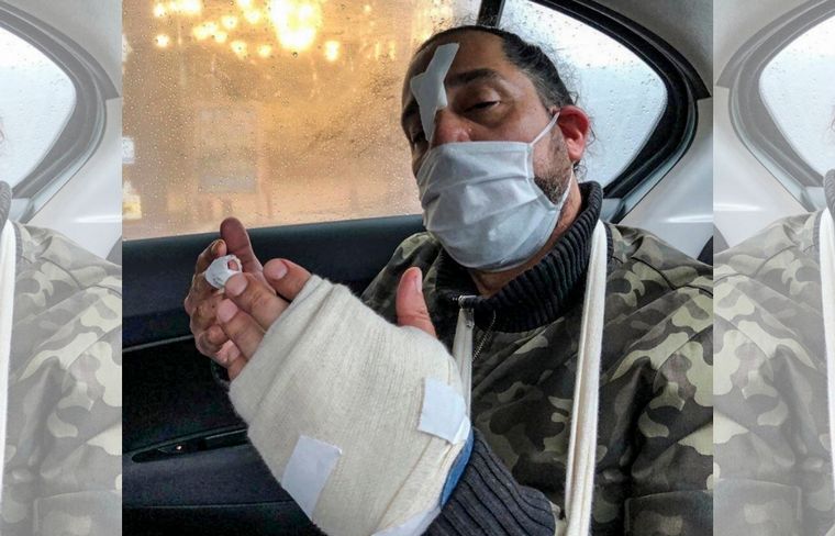 Así quedó el zapatero Juan Muglia, quien fue baleado en una mano. 