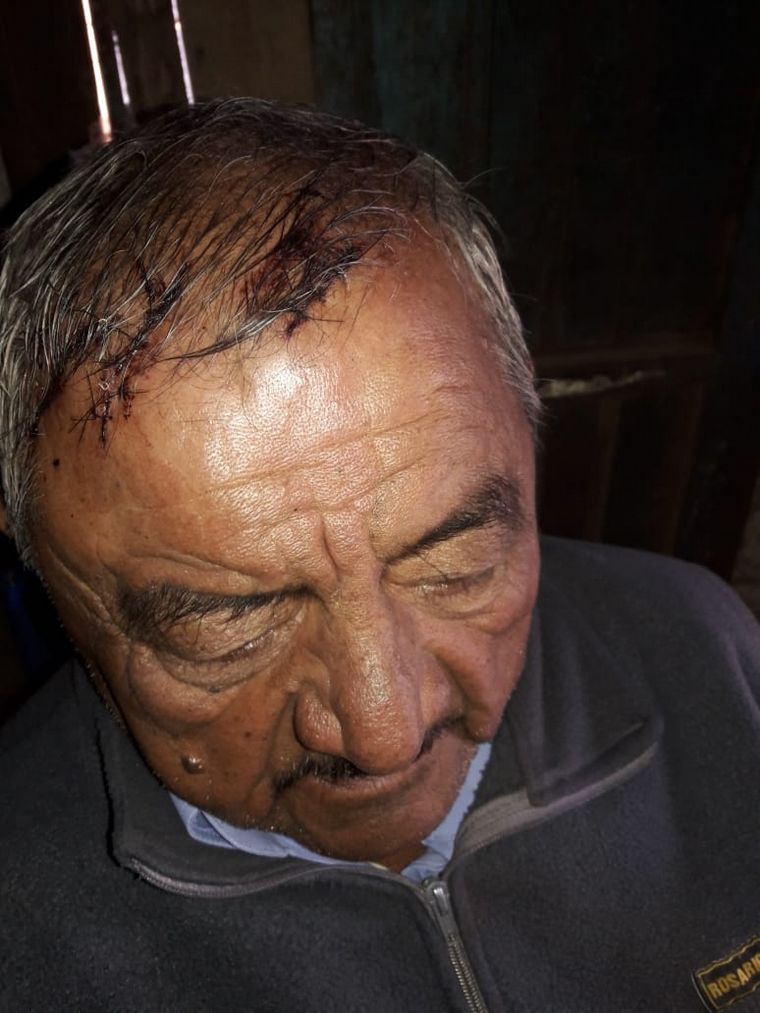 Lo atacaron con palos, fierros y un cuchillo.