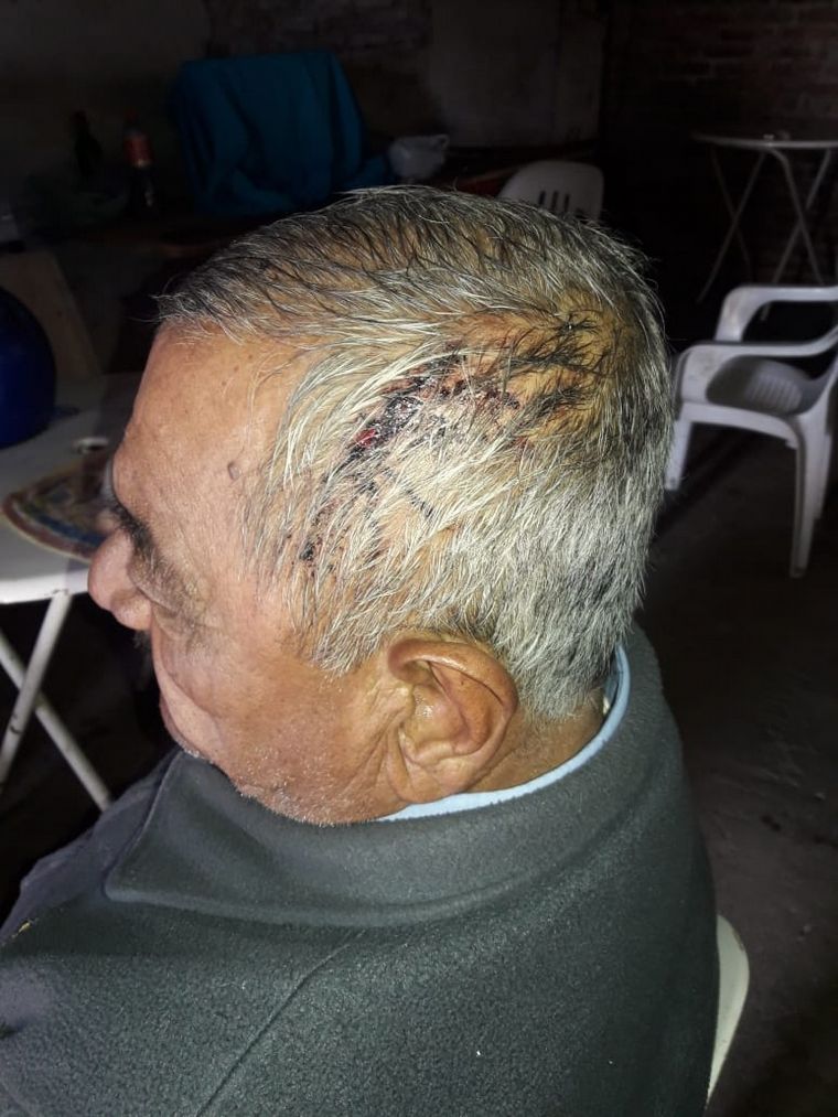 Lo atacaron con palos, fierros y un cuchillo.