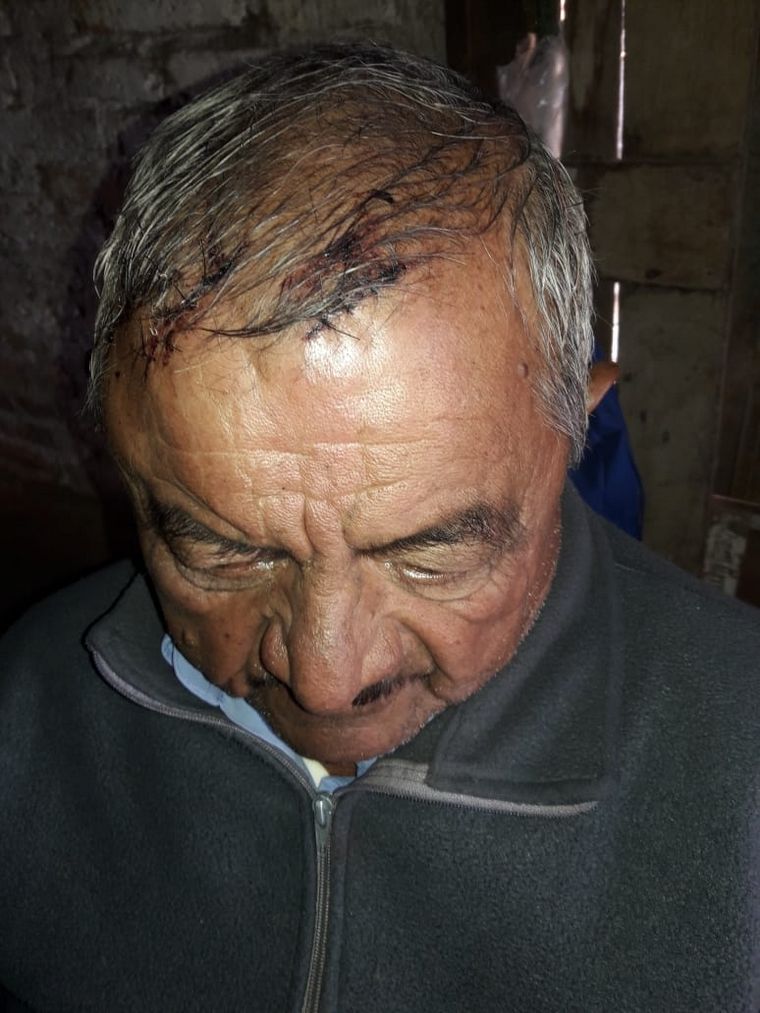 Lo atacaron con palos, fierros y un cuchillo.