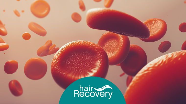 Plasma rico en plaquetas, ahora para recuperar el cabello