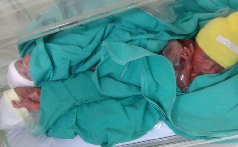 Las tres pesaron alrededor de 1,5 kg y continúan en observación.