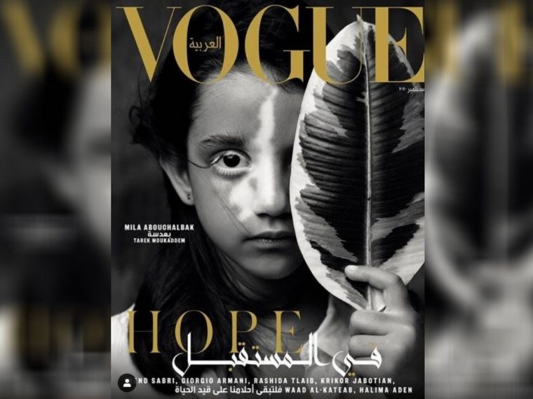 La niña, afectada por las bombas de Beirut, aparecerá en Vogue Arabia.