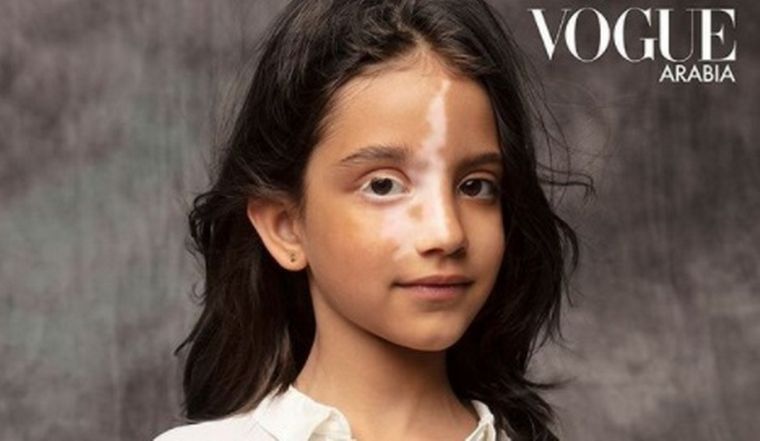 FOTO: La niña, afectada por las bombas de Beirut, aparecerá en Vogue Arabia.