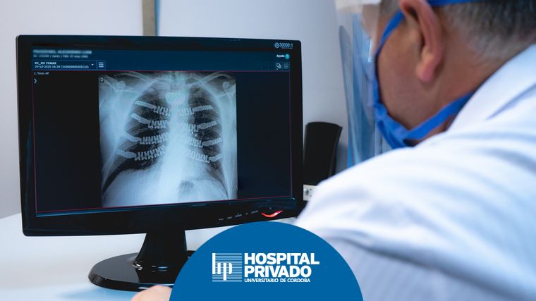 Prótesis 3D a medida