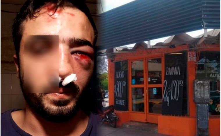 Así quedó el comerciante atacado en la manifestación de los municipales.