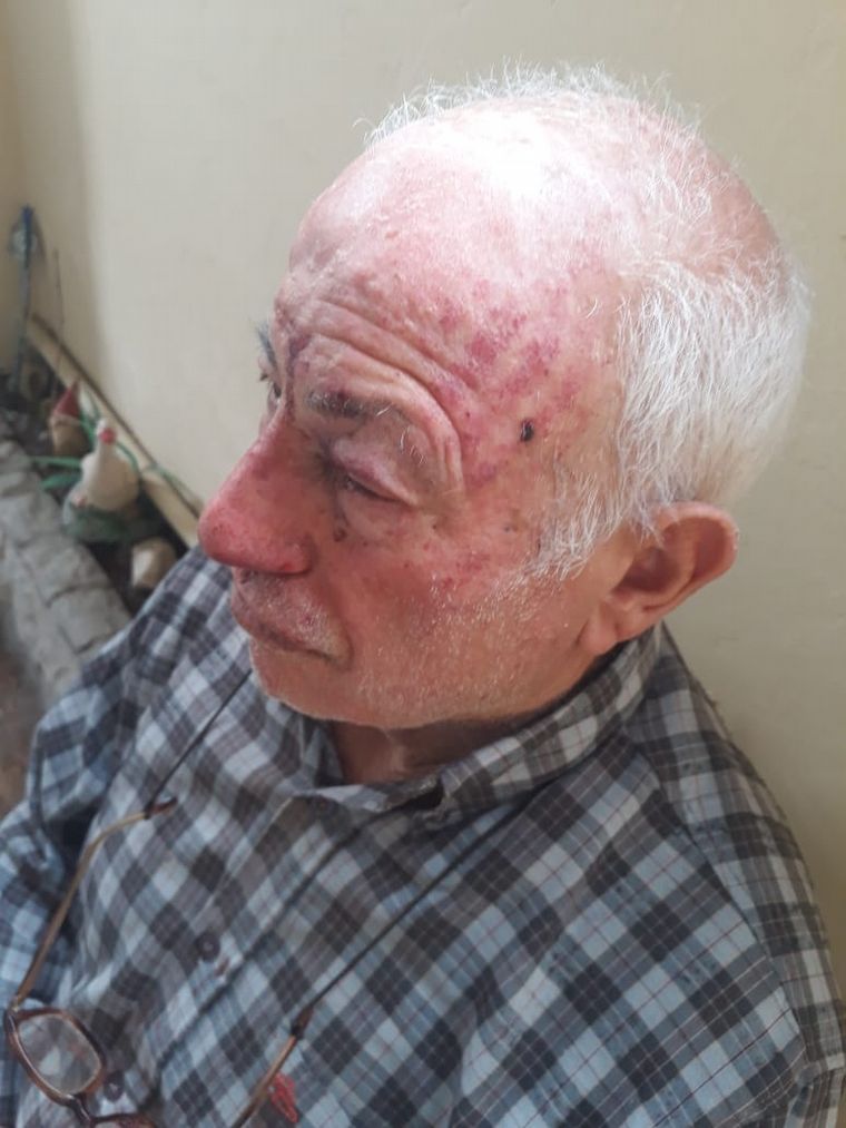 FOTO: Violento robo a una pareja de jubilados en Luis Guillón