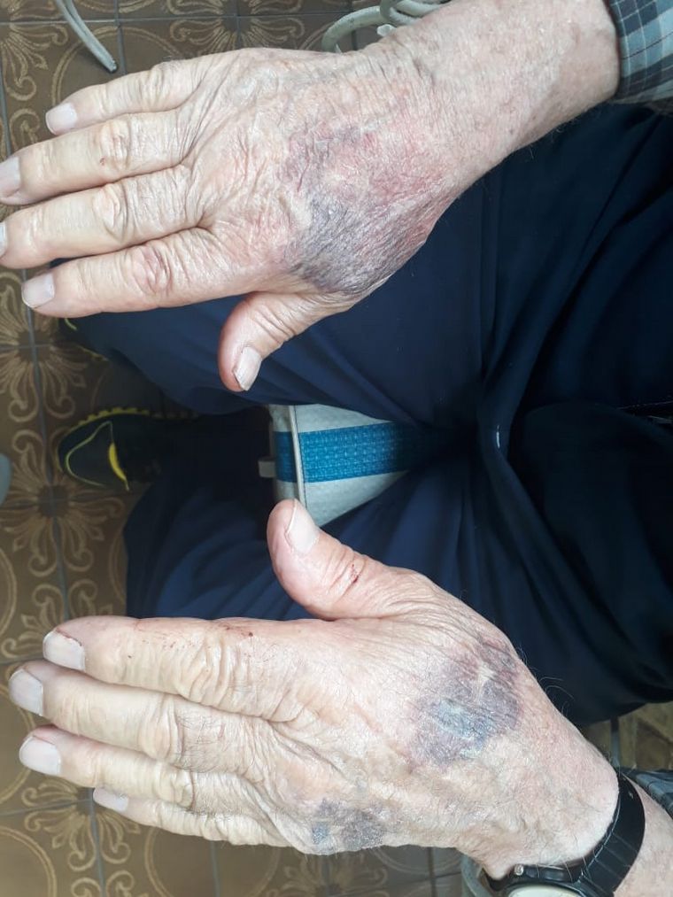 Violento robo a una pareja de jubilados en Luis Guillón