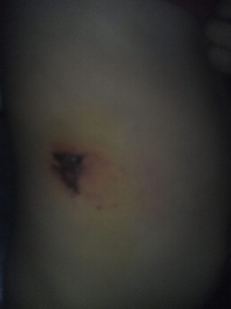 El niño de cuatro años sufrió lesiones en el torso.