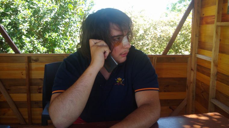 Lautaro Insúa sufrió fractura de nariz y de pómulos.