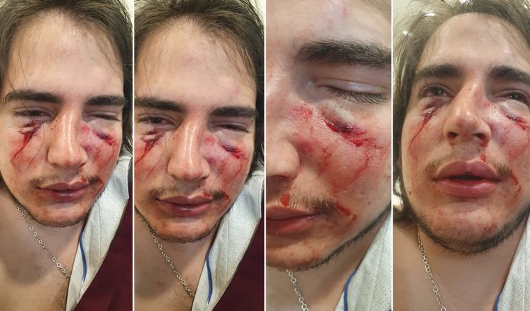 AUDIO: Habló Lautaro Insúa, el joven atacado por rugbiers: 
