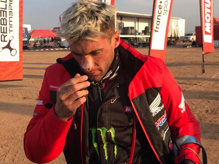 Kevin Benavídez con su nariz lesionada hoy en la quinta etapa.