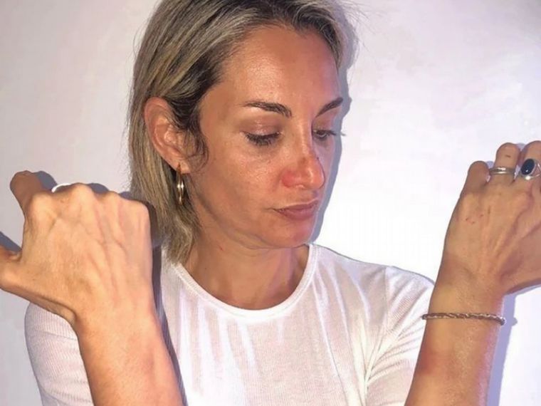 La víctima tiene lesiones en el cuello, cara, brazos y piernas.