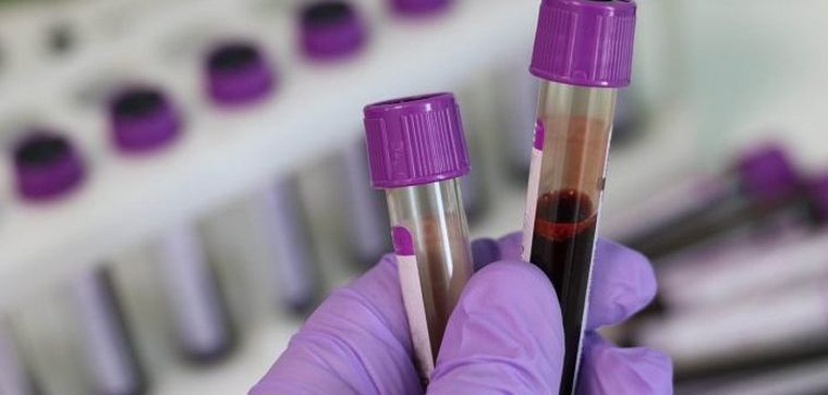 El estudio fue publicado en la revista especializada Blood Advances.