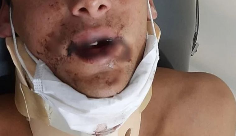 El rugbier atacado en Mar del Plata: (Foto: portal 0223)