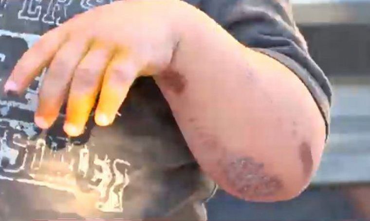 Motochorros arrastraron a un bebé para robarle la mochilita