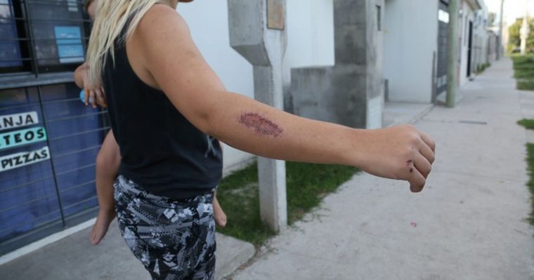 Motochorros arrastraron a un bebé para robarle la mochilita