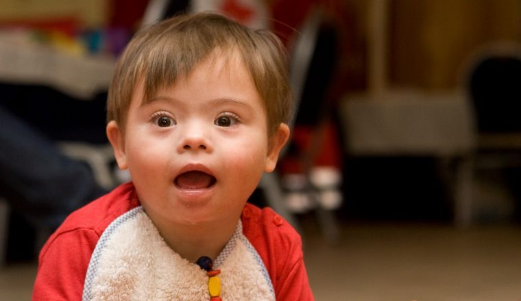 La Asociación Síndrome de Down le respondió al Presidente (Foto ilustrativa)