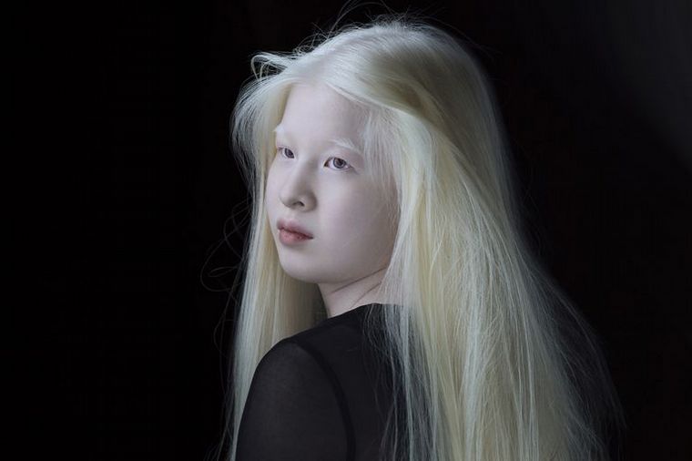 Xueli Abbing (Zebedee Management)