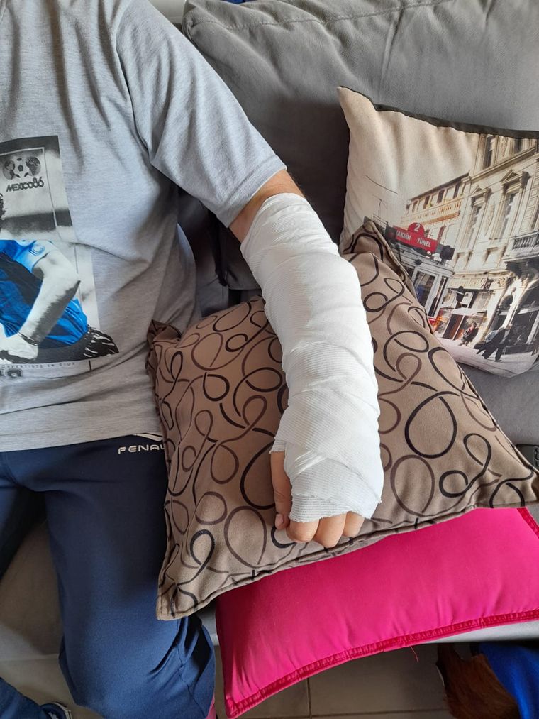 El pitbull le provocó heridas en ambos brazos.