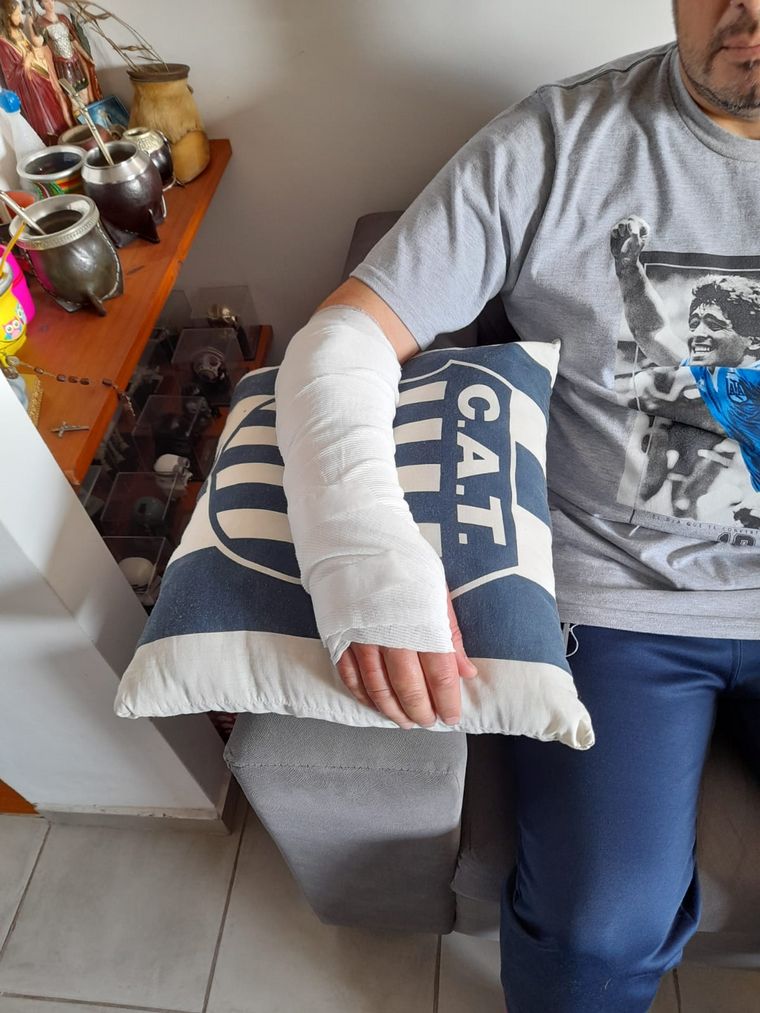 El pitbull le provocó heridas en ambos brazos.