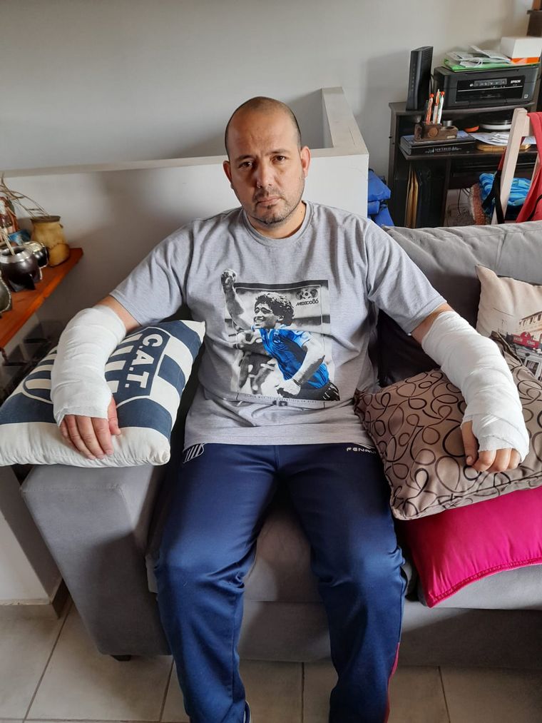 El pitbull le provocó heridas en ambos brazos.