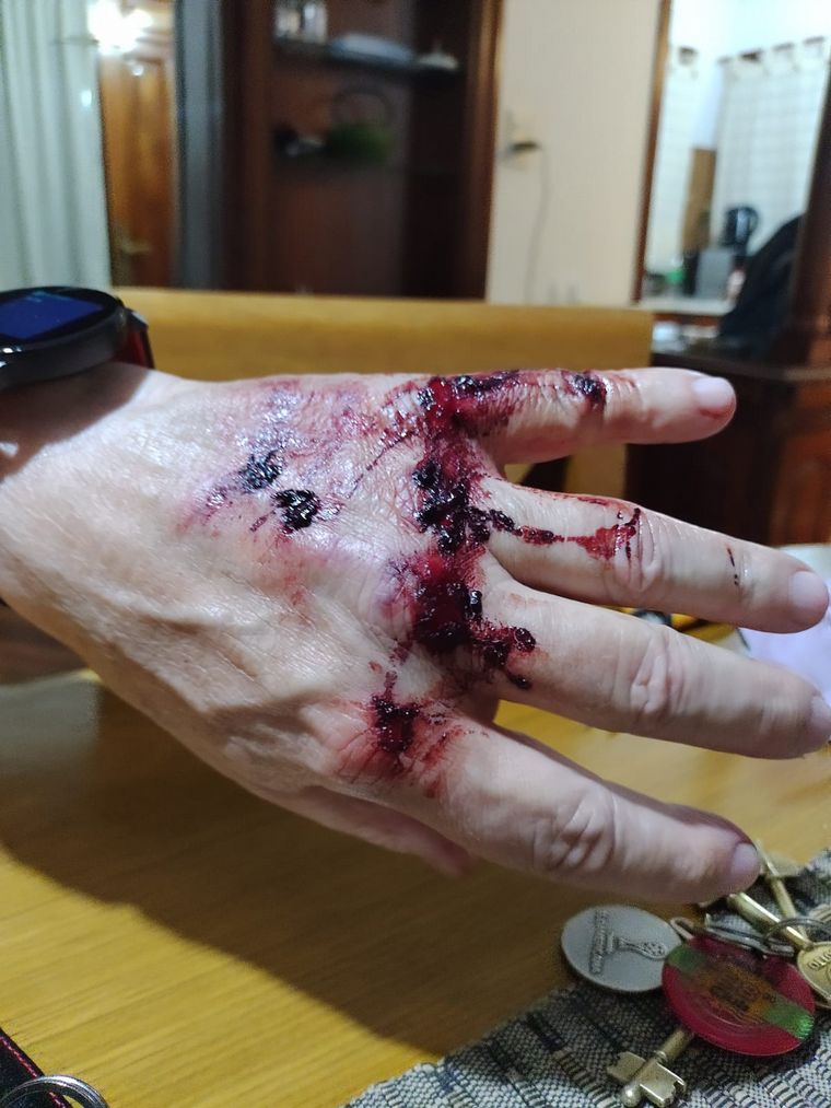 FOTO: Violento asalto al legislador Ambrosio para robarle la bici