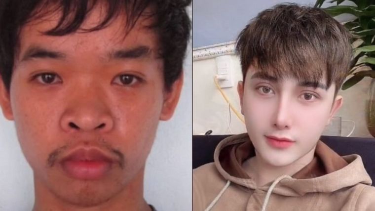 Le dijeron que era feo, se hizo 9 cirugías y ahora es modelo