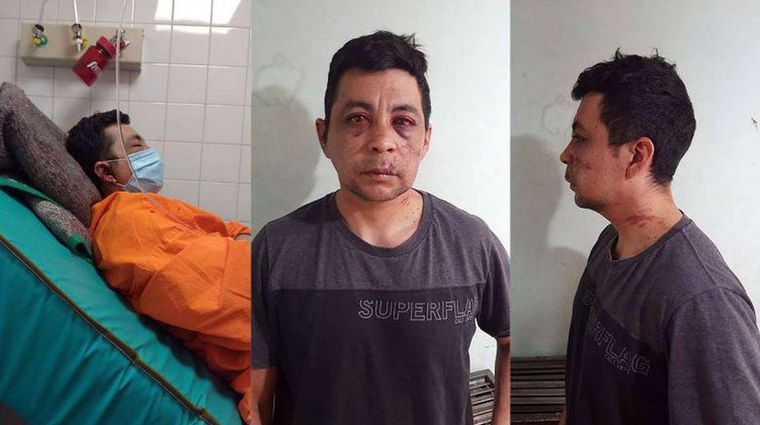 Murió el enfermero linchado por contagiarse de Covid