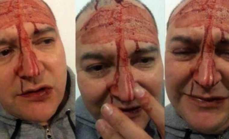 Leo García fue golpeado en General Rodríguez.