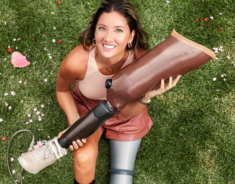 Daniella Álvarez, la ex Miss Colombia que en 2020 perdió su pierna izquierda