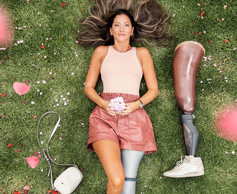 Daniella Álvarez, la ex Miss Colombia que en 2020 perdió su pierna izquierda