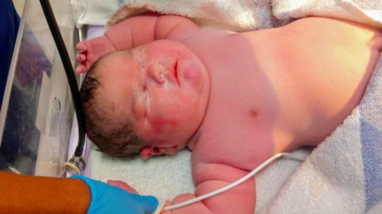 FOTO: Nació por parto natural un bebé de casi 7 kilos