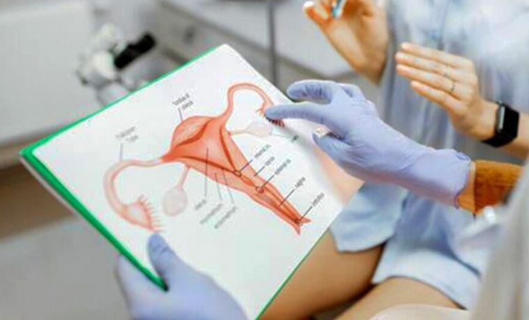 Qué es una histerectomía