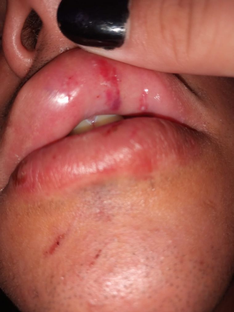 Las lesiones de algunos de los denunciantes de 