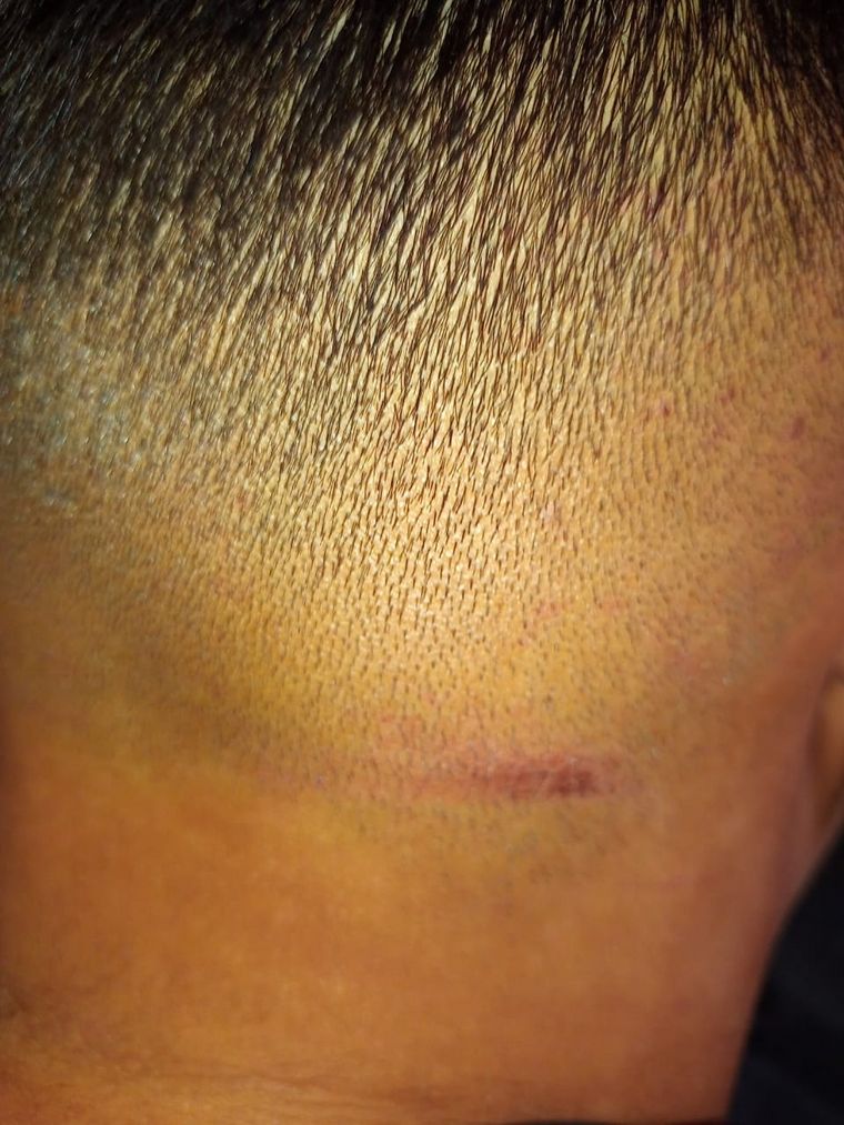 Las lesiones de algunos de los denunciantes de 