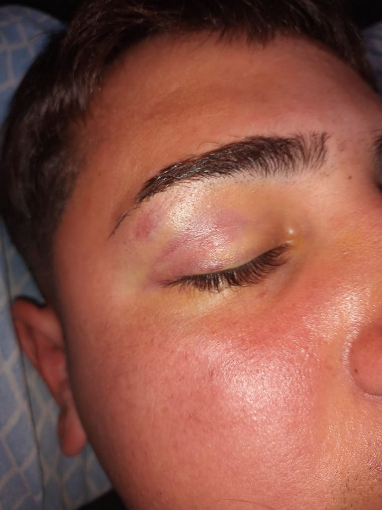 Las lesiones de algunos de los denunciantes de 