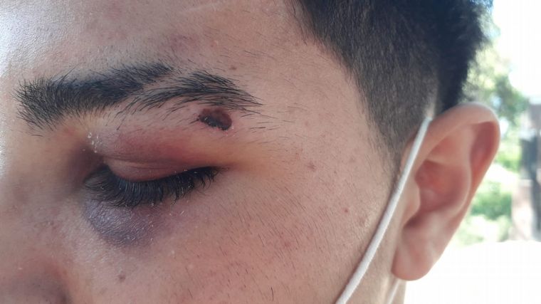 Las lesiones de algunos de los denunciantes de 