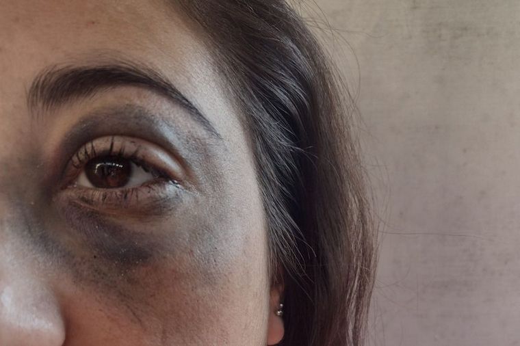 Yésica Brusa, denunciante.