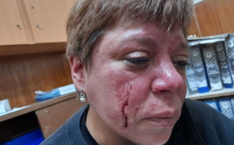 La inspectora agredida.