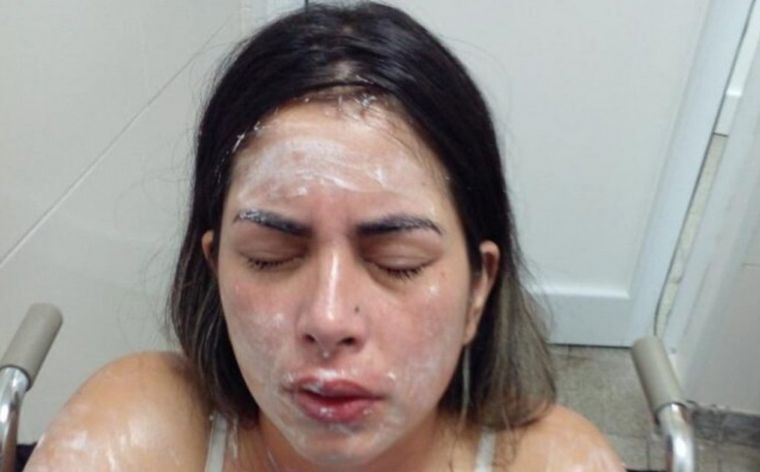 La víctima terminó con lesiones en su rostro, brazos, pecho e irritación en los ojos.