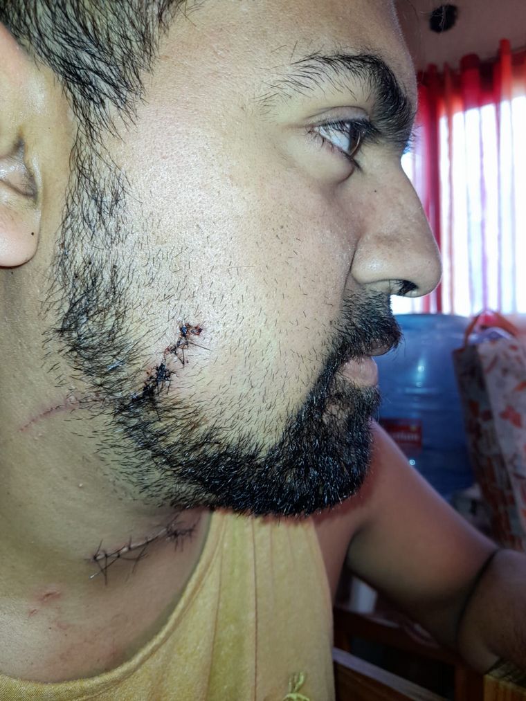 FOTO: El taxista atacado en asalto en Carlos Paz